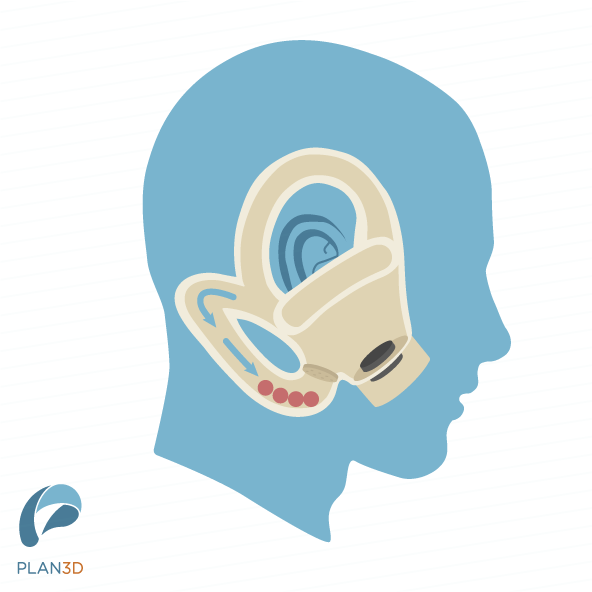 Canales Semicirculares Grande - Derecho