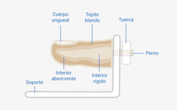 Dedo de Pie con Onicocriptosis