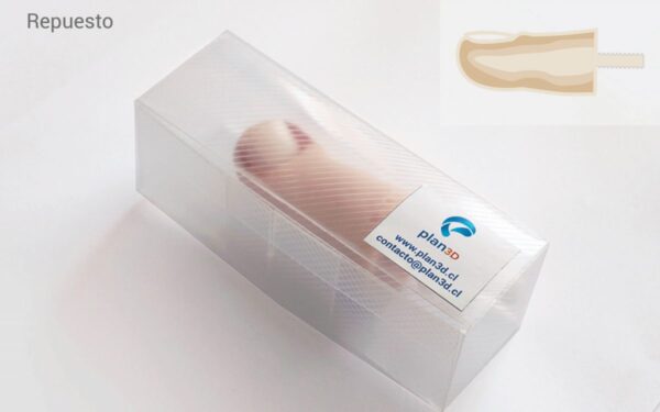 Dedo de Pie con Onicocriptosis