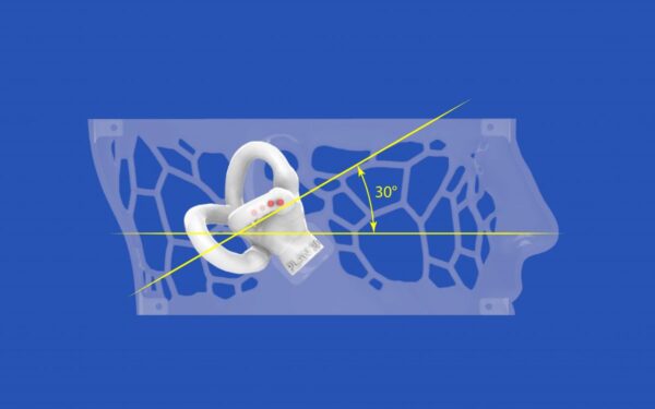 dizzy-head-04.jpeg Dizzy Head