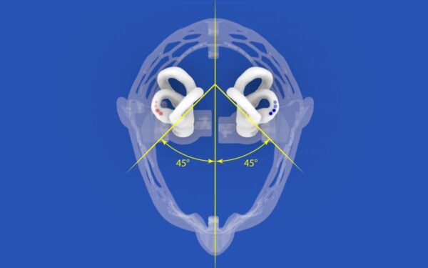 dizzy-head-05.jpeg Dizzy Head