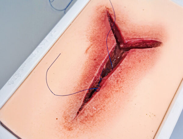 Piel avanzada con 1 herida