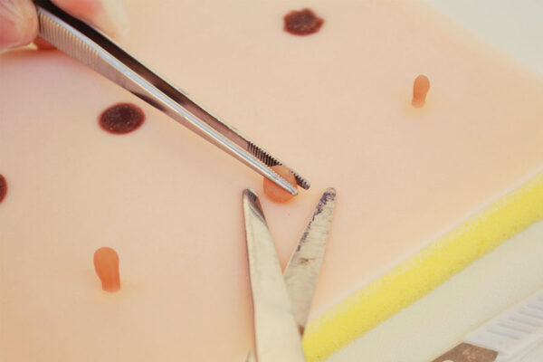 Piel de simulación con fibromas y lunares