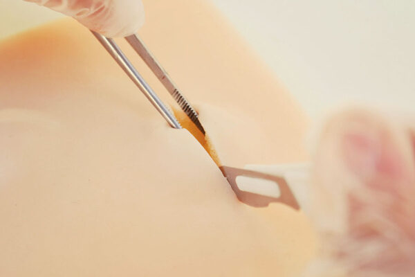 Piel de simulación de Lipomas