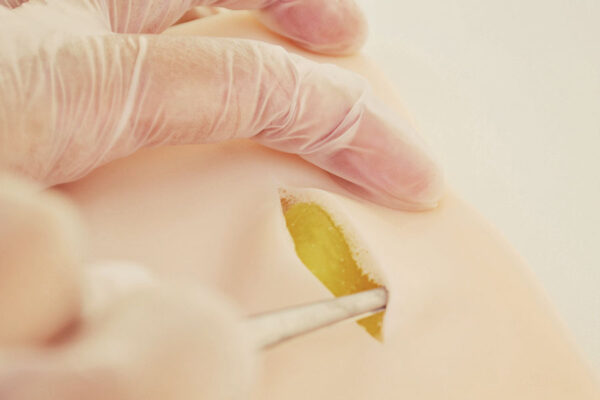 Piel de simulación de Lipomas