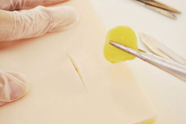 Piel de simulación de Lipomas