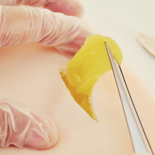 Piel de simulación de Lipomas