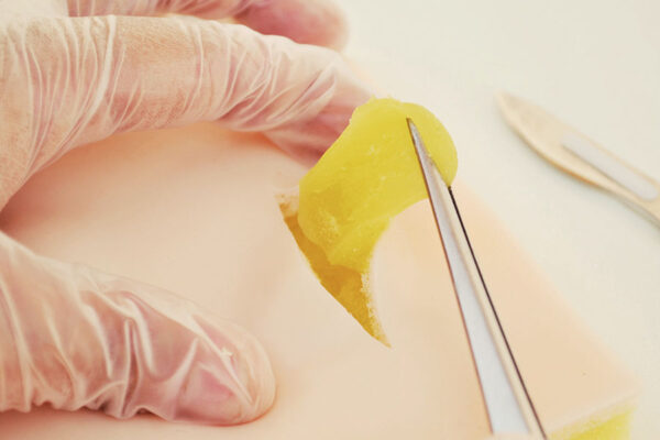 Piel de simulación de Lipomas