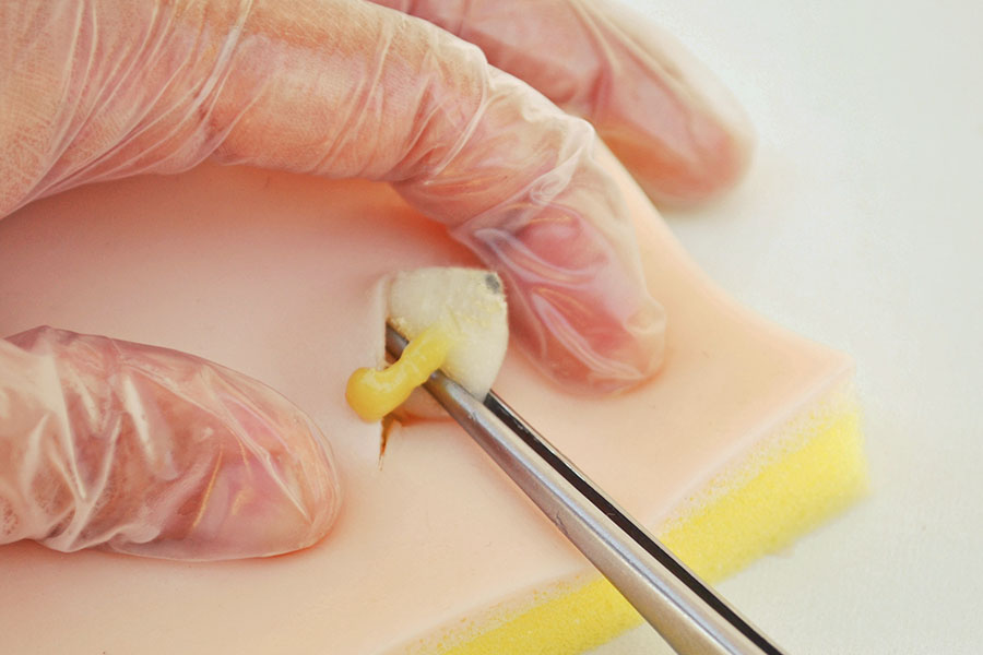 Piel de simulación con quistes sebáceos