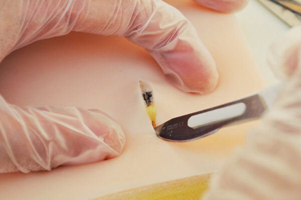 Piel de simulación con quistes sebáceos