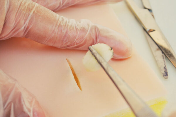 Piel de simulación con quistes sebáceos