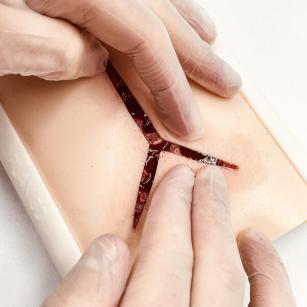 Piel avanzada con 1 herida