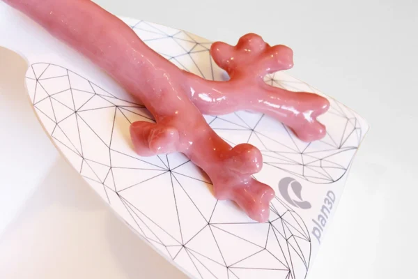 Simulador de Broncoscopía