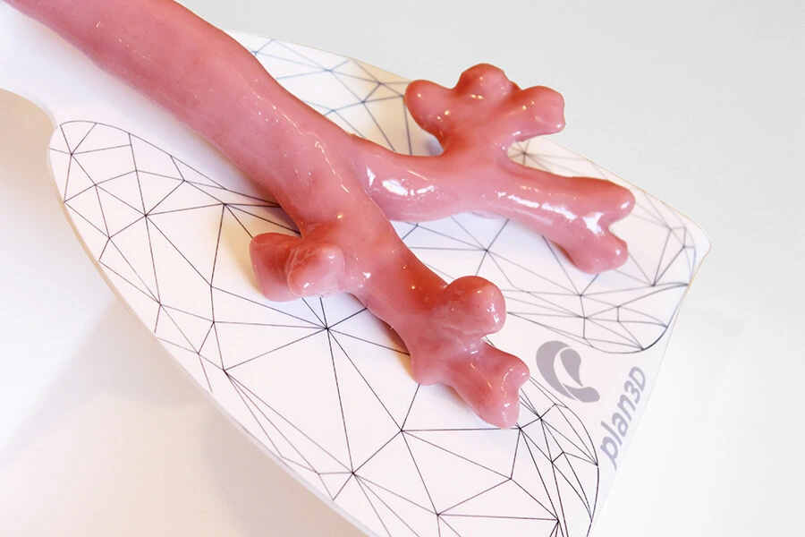 Simulador de Broncoscopía