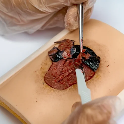 Kit de Inicio Úlcera por Presión (1 soporte+1 piel+5 repuestos)