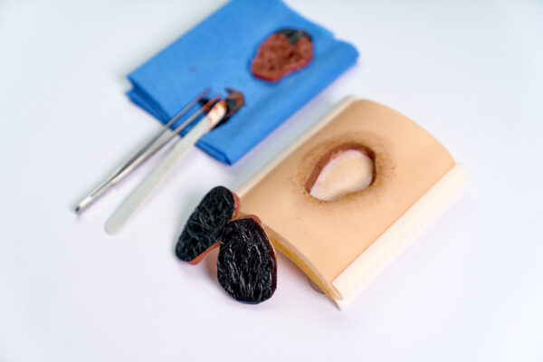 Kit de Inicio Úlcera por Presión (1 soporte+1 piel+5 repuestos)