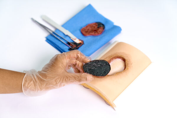 simulador-ulcera-06.jpeg 10 Repuestos de Úlcera por Presión