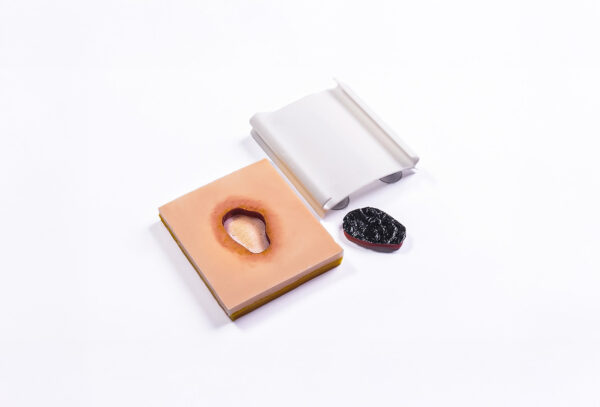 Ulcera-presion-02 Úlcera por presión