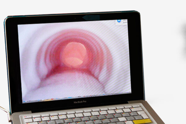 Simulador de cricotiroidotomía avanzado