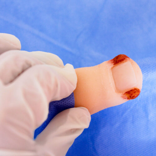 Repuesto de dedo de pie