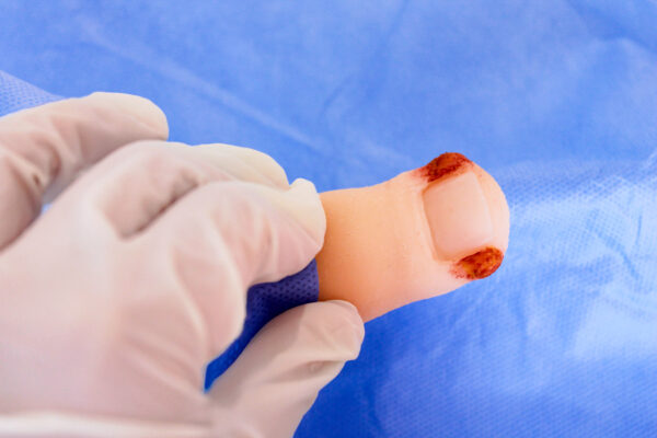 Repuesto de dedo de pie