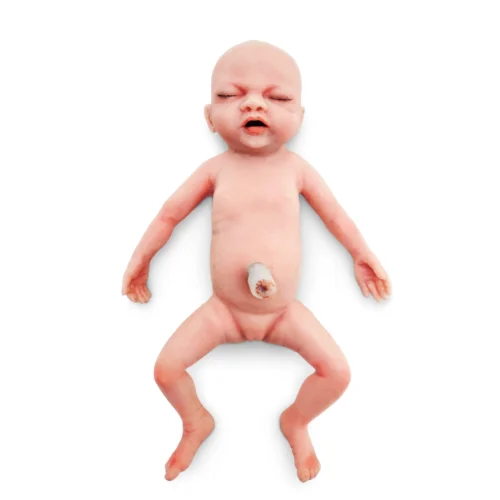 BabyLibby-02 Baby Libby - Gastrosquisis