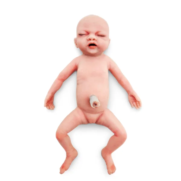 BabyLibby-02 Baby Libby - Gastrosquisis