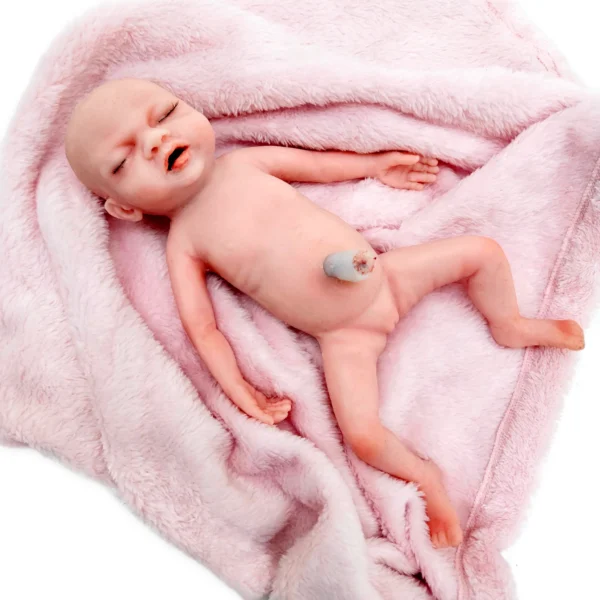 BabyLibby-03 Baby Libby - Gastrosquisis