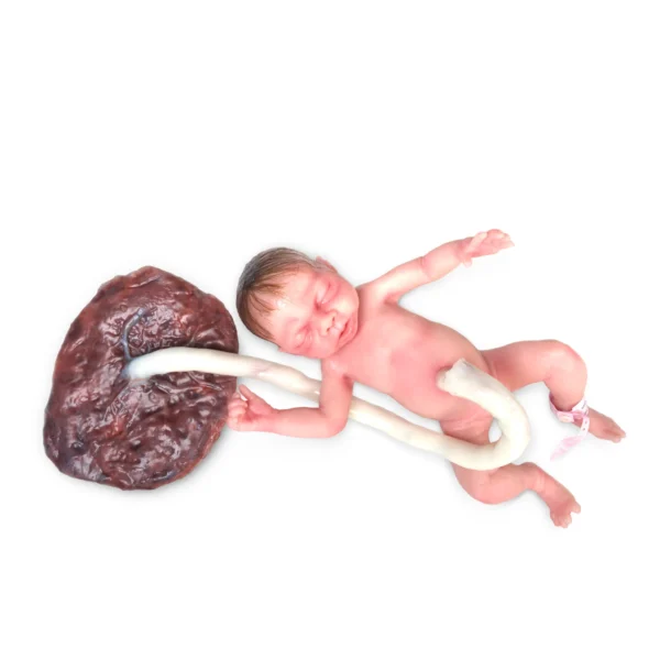 Baby Lara - Bebé prematuro de parto