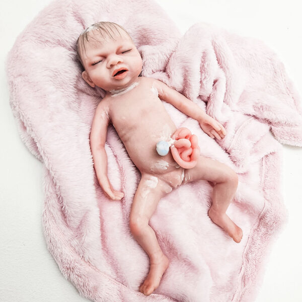 babylibby_gastro01 Baby Libby - Gastrosquisis
