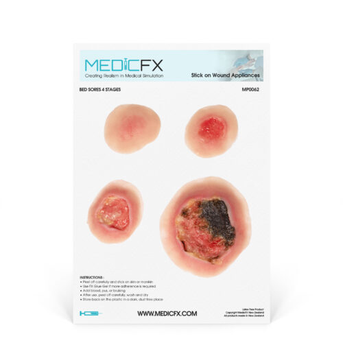MP0062_medicfx Lámina de Úlceras por Presión 4 Etapas