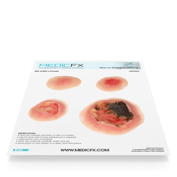 MP0062_medicfx_0 Lámina de Úlceras por Presión 4 Etapas