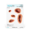 Lámina de Heridas Sucias
